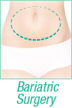 bariatric surgery