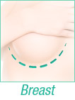 Breast Surgery