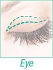 eye surgery