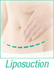 liposuction