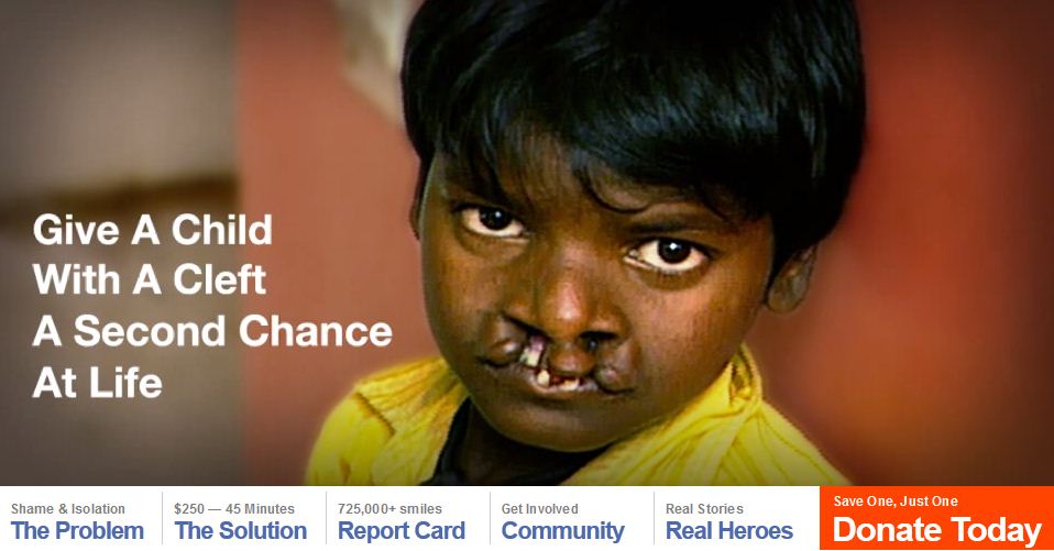 Donate to Smile Train Logo